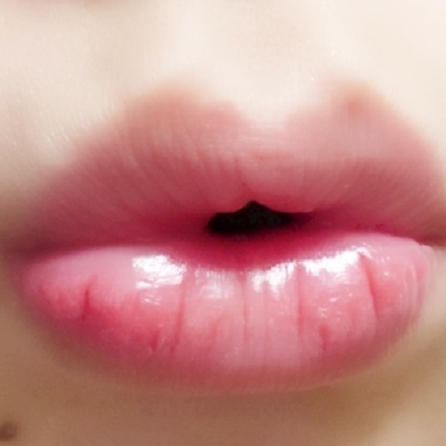 ない 痛く 唇 腫れ 唇の腫れを治す方法: 15